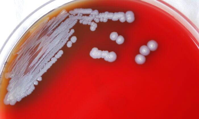 Bacteria That Causes Rare Tropical Disease Found in US Soil