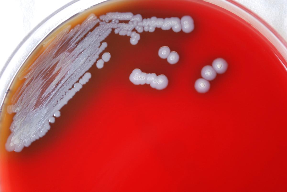 Bacteria That Causes Rare Tropical Disease Found in US Soil