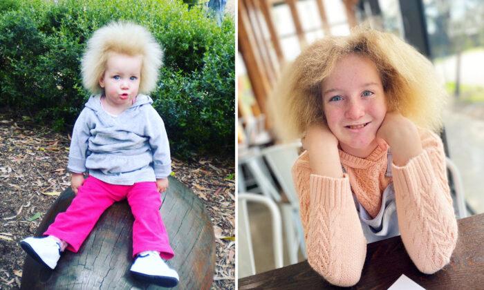 ‘She Is Just Perfect’: Girl With ‘1-in-a-Million’ Hair Disorder Embraces Resilience, Inspires Others