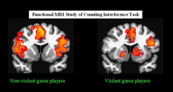 MRI scans comparing emotional processing between children that play a violent game just beforehand as compared to those playing a non-violent game (Radiological Society of North America)