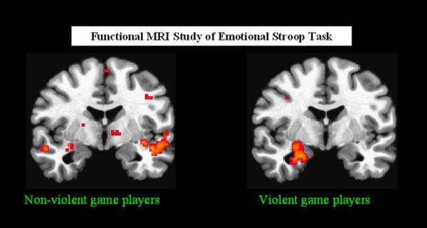 MRI scans comparing emotional processing between children that play a violent game just beforehand, as compared to playing a non-violent game (Radiological Society of North America)