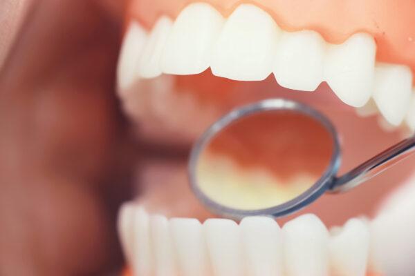 <span class="caption">Having good dental hygiene, a healthy low sugar diet and regular dental checks up can help prevent gum disease. </span>(By alexkich/Shutterstock)