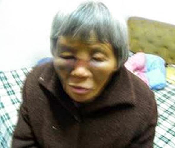 Wang Liuzhen was often abused and beaten by the personnel monitoring her. (Courtesy of Minghui.org)