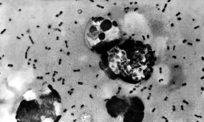Oregon Reports First Human Case of Bubonic Plague in Nearly a Decade