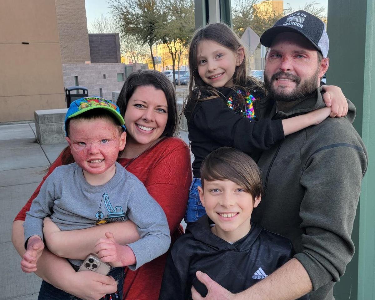 Dad Kyle and 4-year-old Krew were severely injured in the explosion. Pepper, 12, suffered over 52 percent burns in the accident and is still in the hospital. (Courtesy of <a href="https://www.facebook.com/Copeland.Family.Updates/">The Copeland Family Updates</a>)