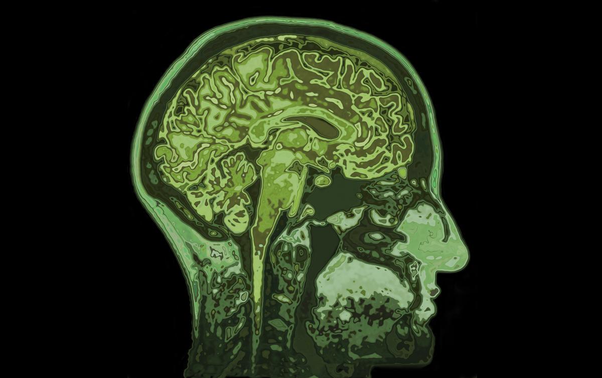 MRI image of head showing human brain. (Illustration – SpeedKingz/Shutterstock)