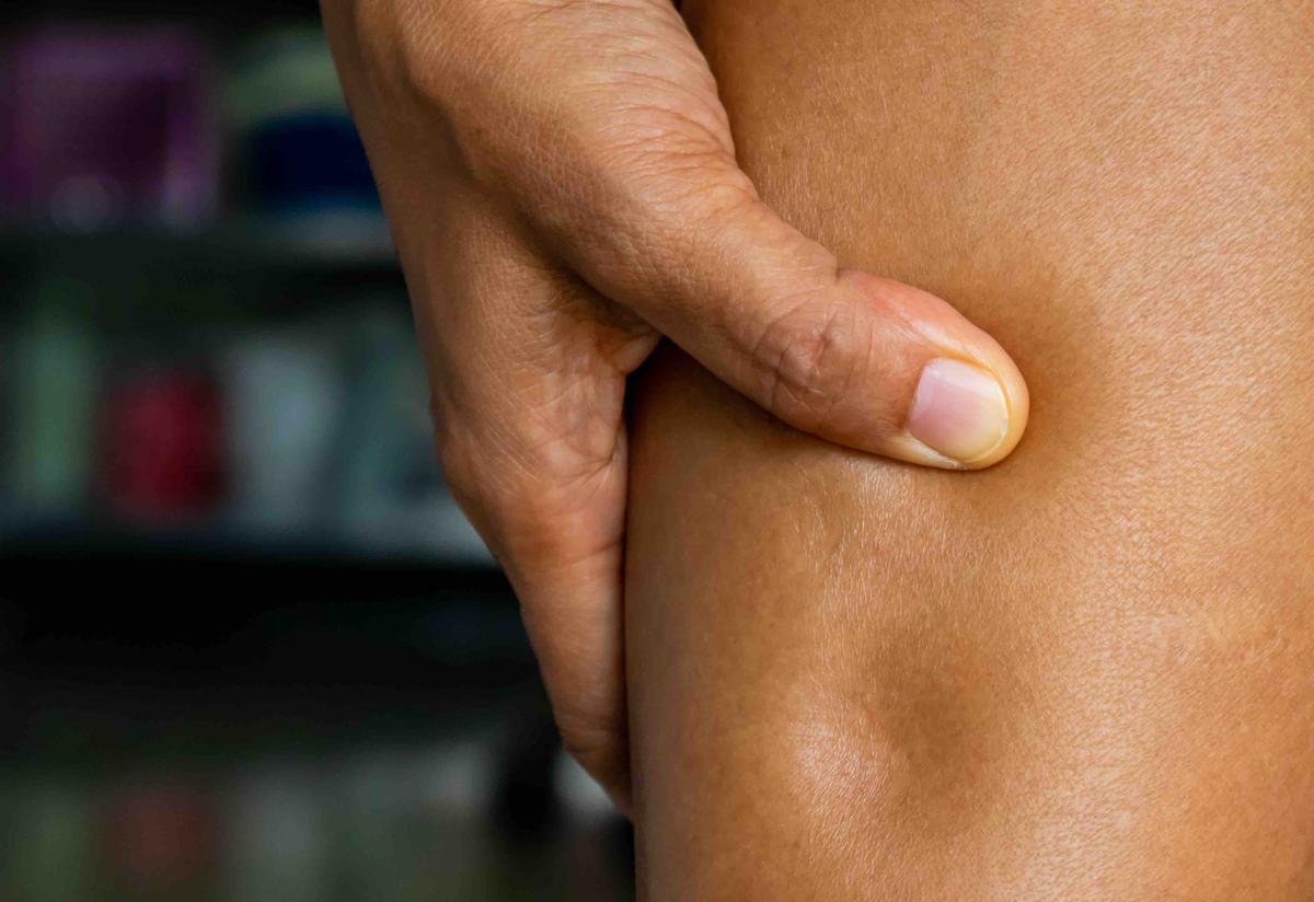 When Body Parts Swell