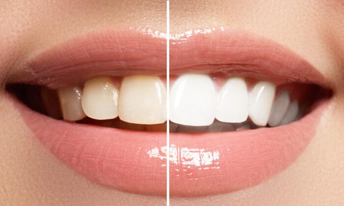 Natural Ways to Whiten Your Teeth at Home