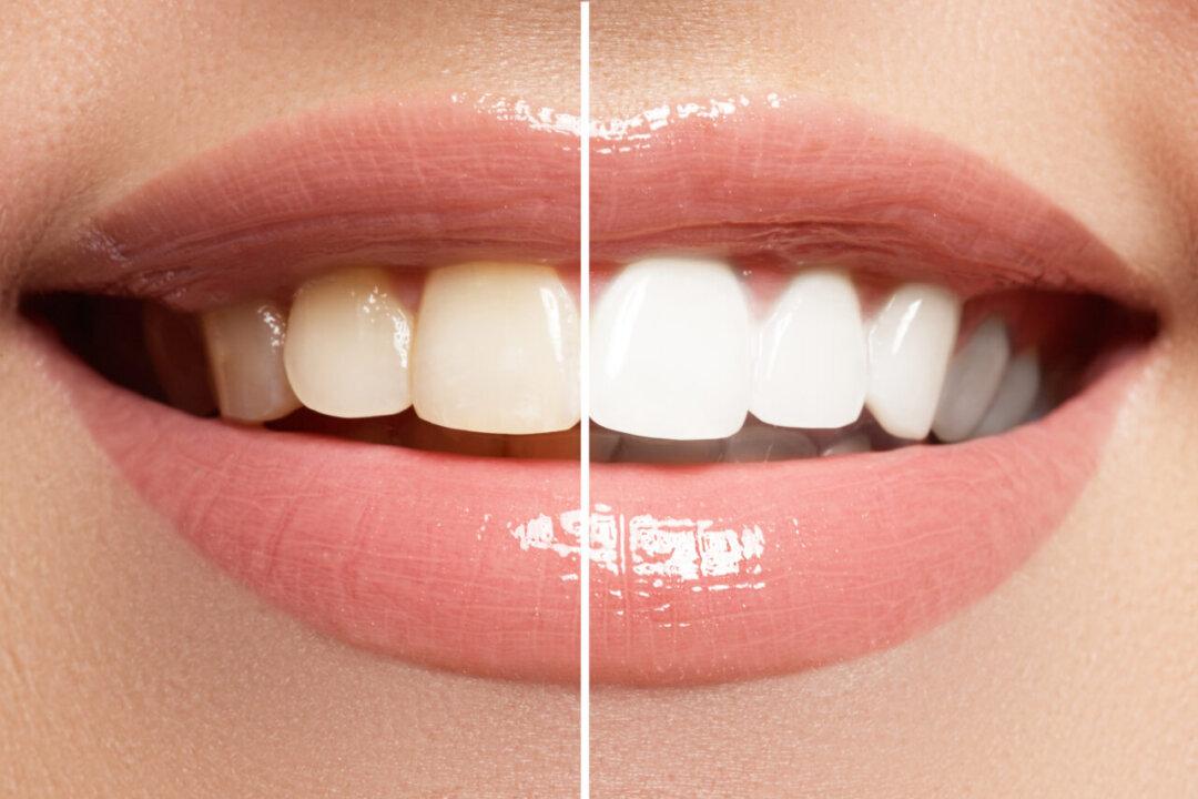 Australian Dentists Says Be Safe When Seeking the Perfect Selfie Smile