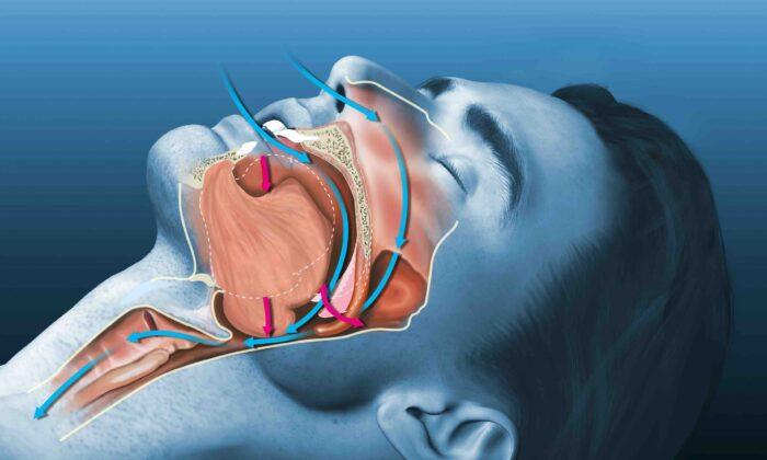 Snoring, Bad Breath May Be Signs of Foundational Health Issues