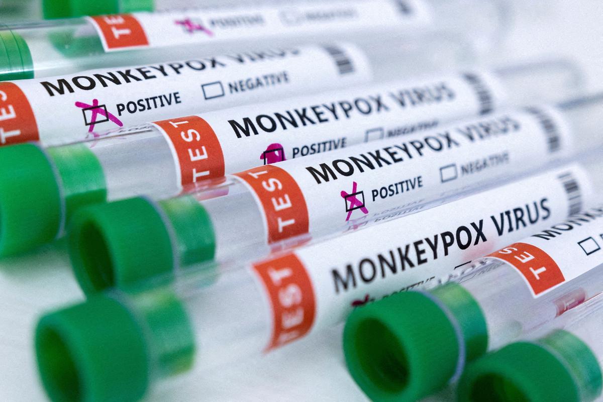 CDC Recommends 2-Dose Monkeypox Vaccine Despite a ‘Small’ Risk