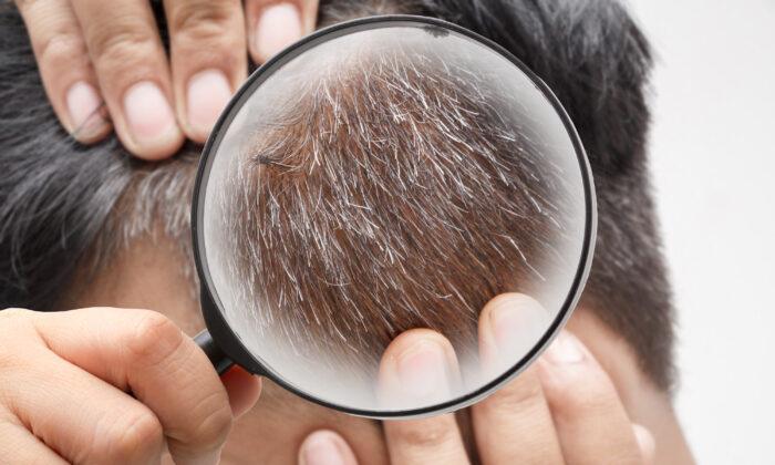 Gray Hair Can Regain Its Color
