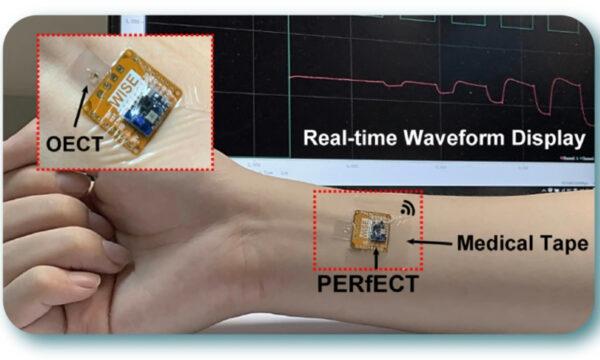 The University of Hong Kong's coin-sized wearable bioelectronic sensor monitors blood sugar levels as well as other health conditions. (The University of Hong Kong)