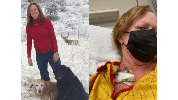 Photos of Debbie Botzum-Pearman before (left) and after neuromyelitis optica (Courtesy of Debbie Botzum-Pearman).