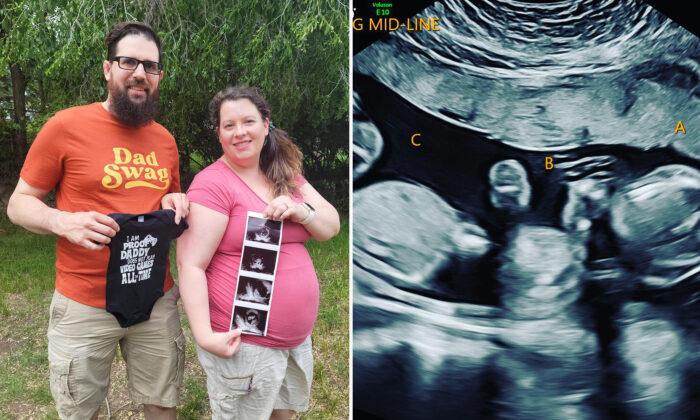 Shocked Couple Are Expecting Rare, Naturally Conceived ‘One in 100,000’ Identical Triplets