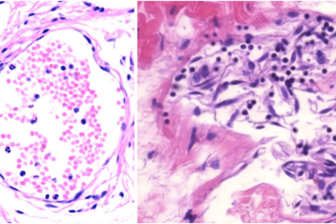 ‘Irrefutable Proof’ Study on mRNA Vaccines Causing Damage: Doctors Respond to WHO Fact-Checking Branch