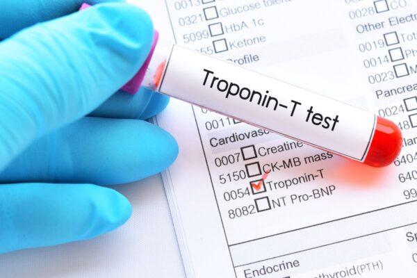 Troponin is a protein that appears in the blood when heart muscles become damaged. (jarun011/Adobe Stock)