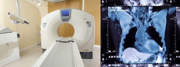 Employing cardiac CT scans to investigate mild heart attacks could lower the risk of complications and minimise the need for patients to travel to metropolitan health facilitiies. (Tawesit/Adobe Stock)