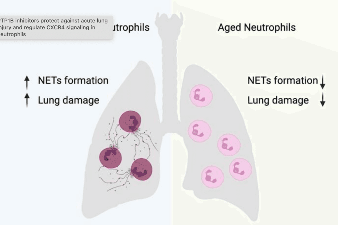 Research Finds New Drug Candidate to Prevent Lethal Lung Inflammation