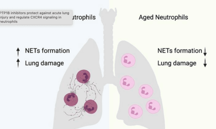 Research Finds New Drug Candidate to Prevent Lethal Lung Inflammation