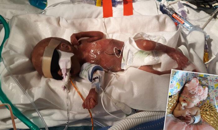 ‘She Is a Blessing From Above’: Baby Born at 22 Weeks Continues to Defy Odds