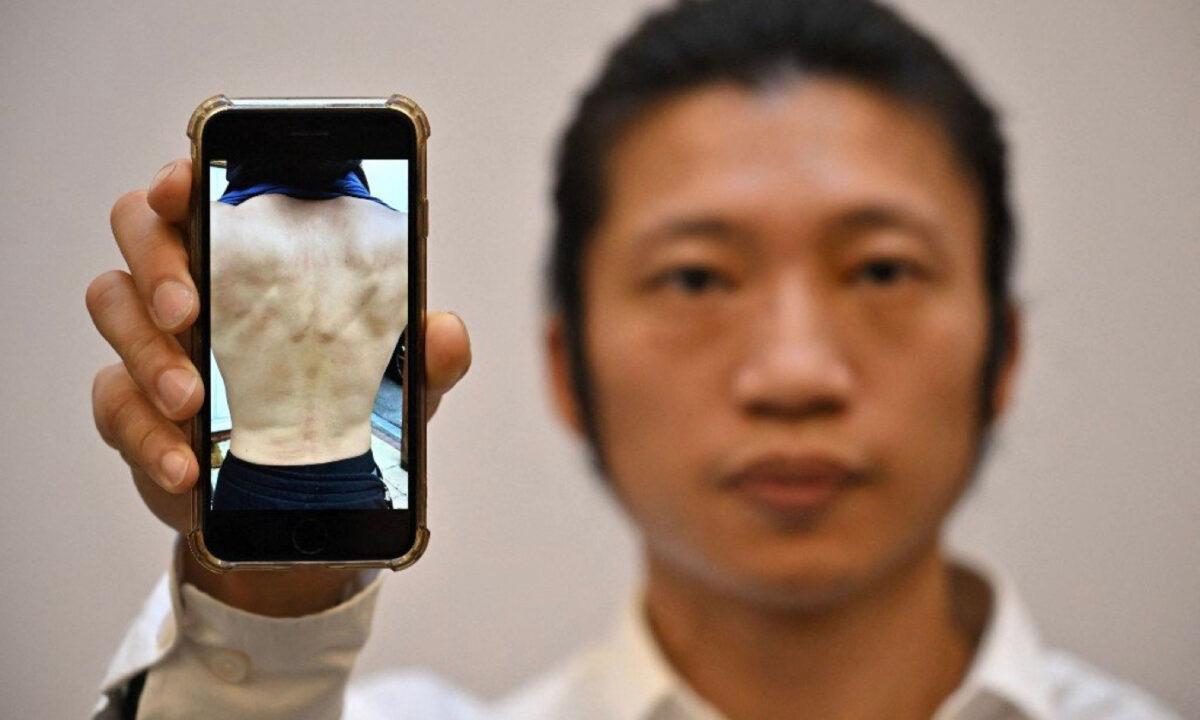 Hong Kong pro-democracy protester Bob Chan poses with a picture on his phone showing injuries following the assault at Manchester China Consulate during a demonstration three days earlier, at a press conference, in London, on Oct. 19, 2022. (Ben Stansall/AFP via Getty Images)