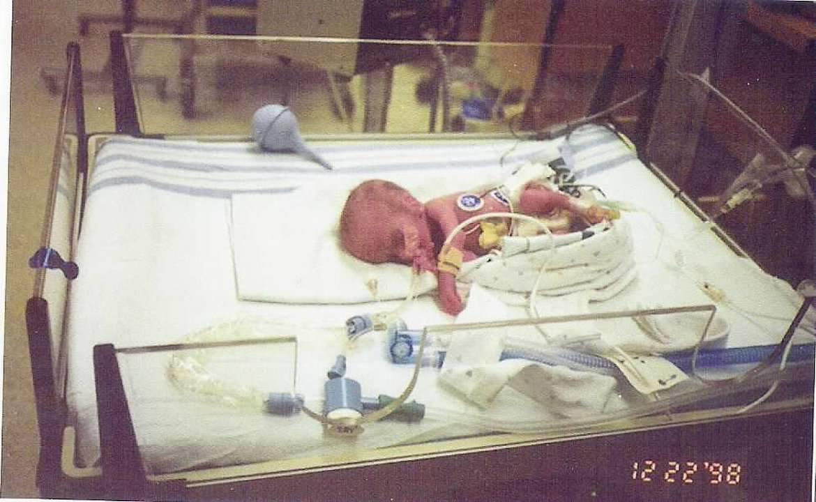 Sienna at birth. She was born with Primordial Dwarfism and Dandy-Walker syndrome. (Courtesy of <a href="https://www.facebook.com/officialChrissyBernal">Chrissy Bernal</a>)
