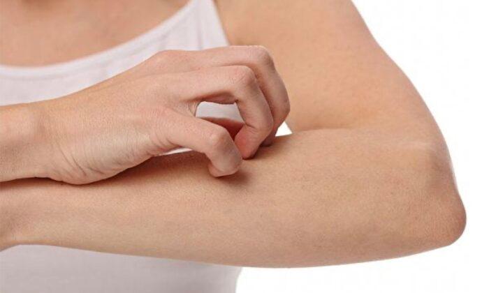 Food, Clothing, Home Environment Cleaning Tips to Avoid Dry Skin and Prevent Eczema in Winter