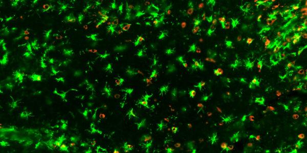 A COVID-19 infected mouse brain showing 'angry' microglia in green and SARS-CoV-2 in red. (Image Supplied by Eduardo Albornoz Balmaceda/UQ)
