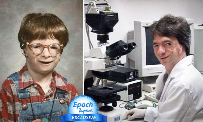 Boy With Rare Facial Deformities Was Given Up by His Parents, Grows Up to Earn PhD in Craniofacial Science