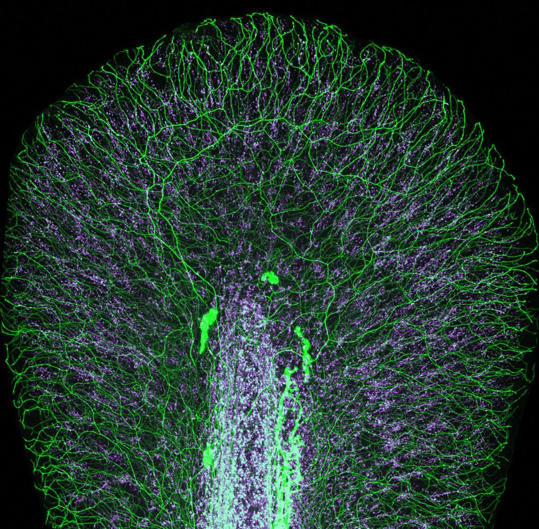 Tail fin of a zebrafish larva with peripheral nerves (green) and extracellular matrix (violet), taken by Dr. Daniel Wehner and Julia Kolb. (Courtesy of Dr. Daniel Wehner and Julia Kolb and Nikon Small World)