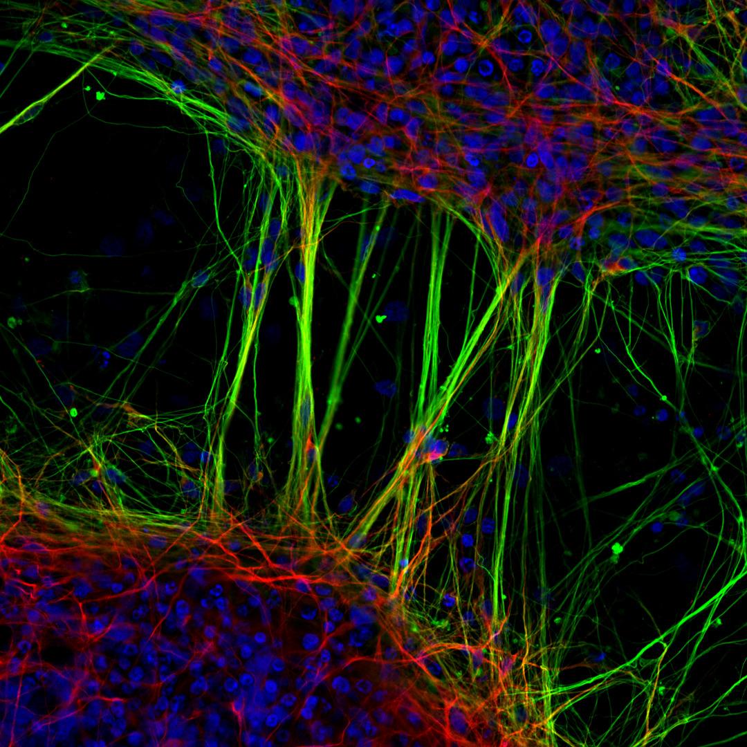 Human neurons derived from neural stem cells, taken by Dr. Jianqun Gao and Prof. Glenda Halliday. (Courtesy of Dr. Jianqun Gao and Prof. Glenda Halliday and Nikon Small World)