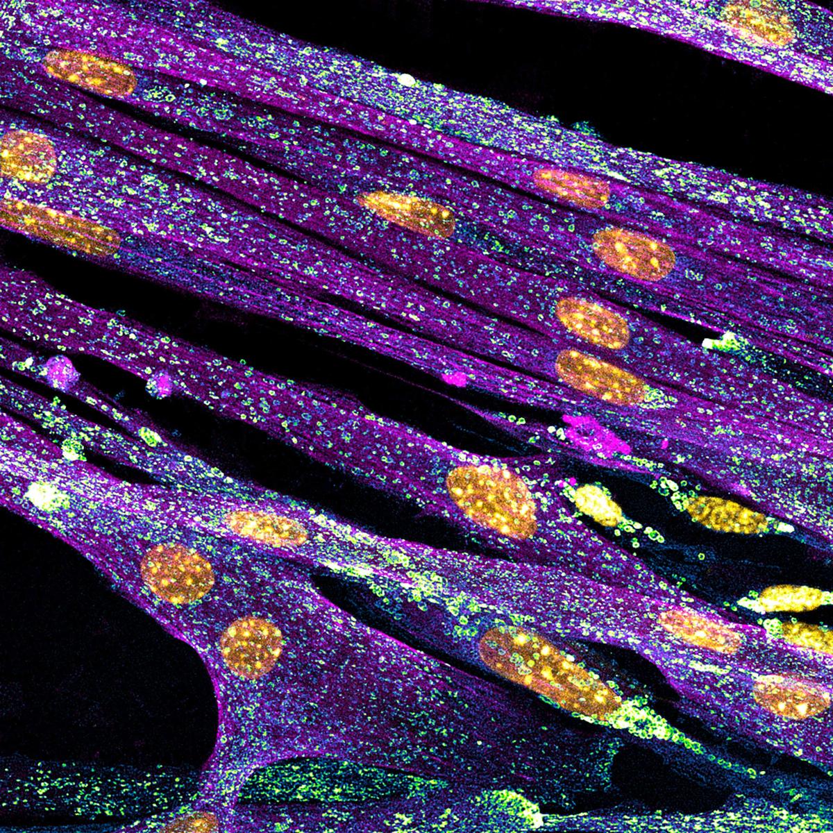 Differentiated cultured mouse myoblasts with lysosomes (cyan/green), nuclei (yellow), and F-actin (magenta), taken by Nadia Efimova. (Courtesy of Nadia Efimova and Nikon Small World)