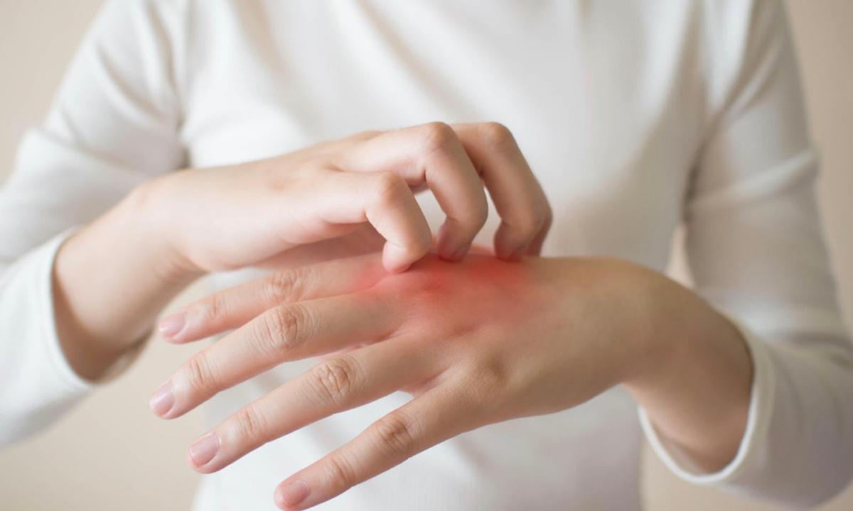 Eczema can be daunting when the symptoms keep recurring. Dr. David Kuo, a traditional Chinese medicine practitioner, recommended acupressure massage to restore the internal system and stop itching effectively. (Shutterstock）