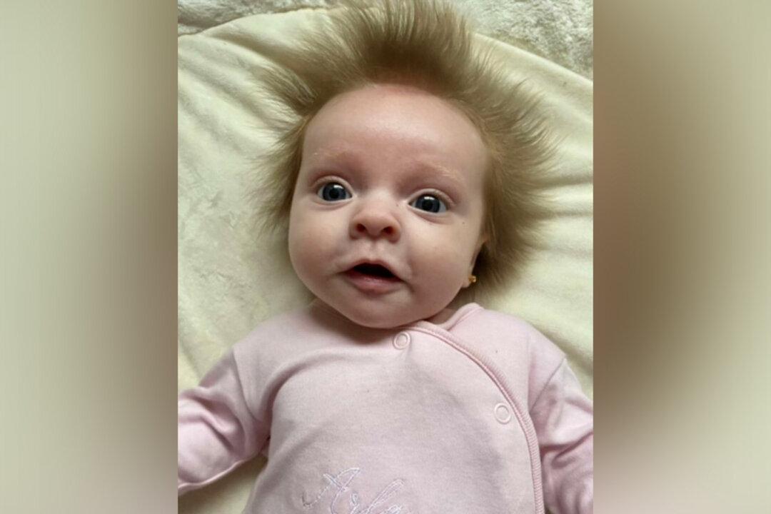 ‘It Just Doesn’t Stay Down’: Baby Is Born With Hair That Sticks Out in All Directions