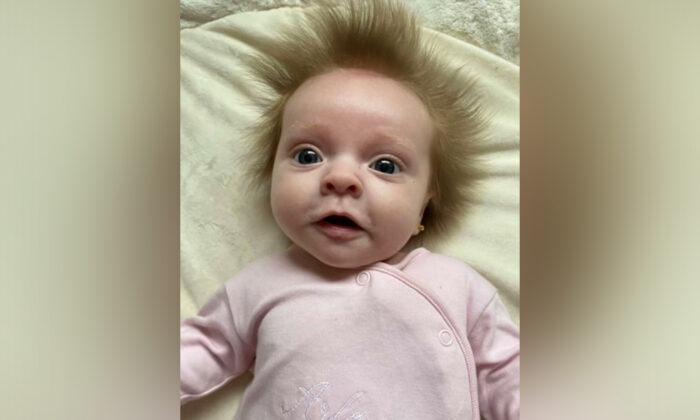 ‘It Just Doesn’t Stay Down’: Baby Is Born With Hair That Sticks Out in All Directions
