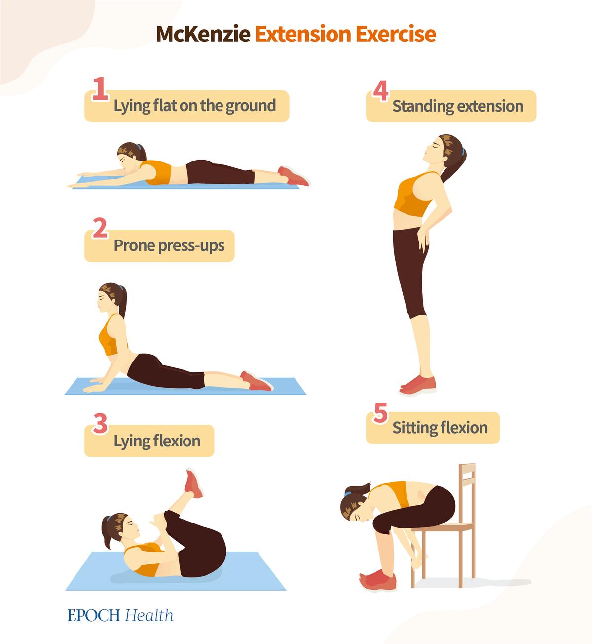 Illustration of the five movements of the McKenzie Extension Exercise.