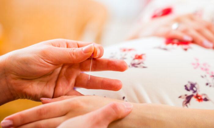 Study: Acupuncture Alleviates Lower Back and Pelvic Pain in Pregnant Women