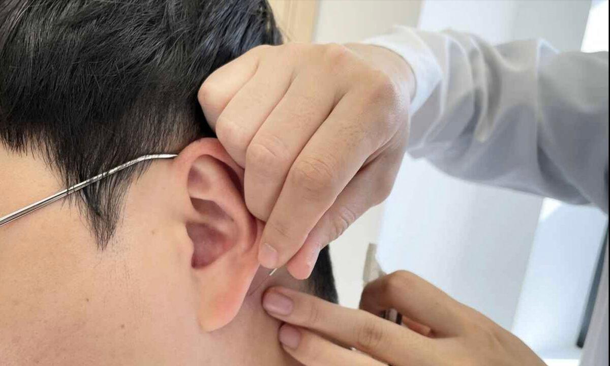 In China, South Korea, and other Asian countries, acupuncture has been used to treat stroke for thousands of years. (Courtesy of Jaseng Center for Alternative Medicine, South Korea)