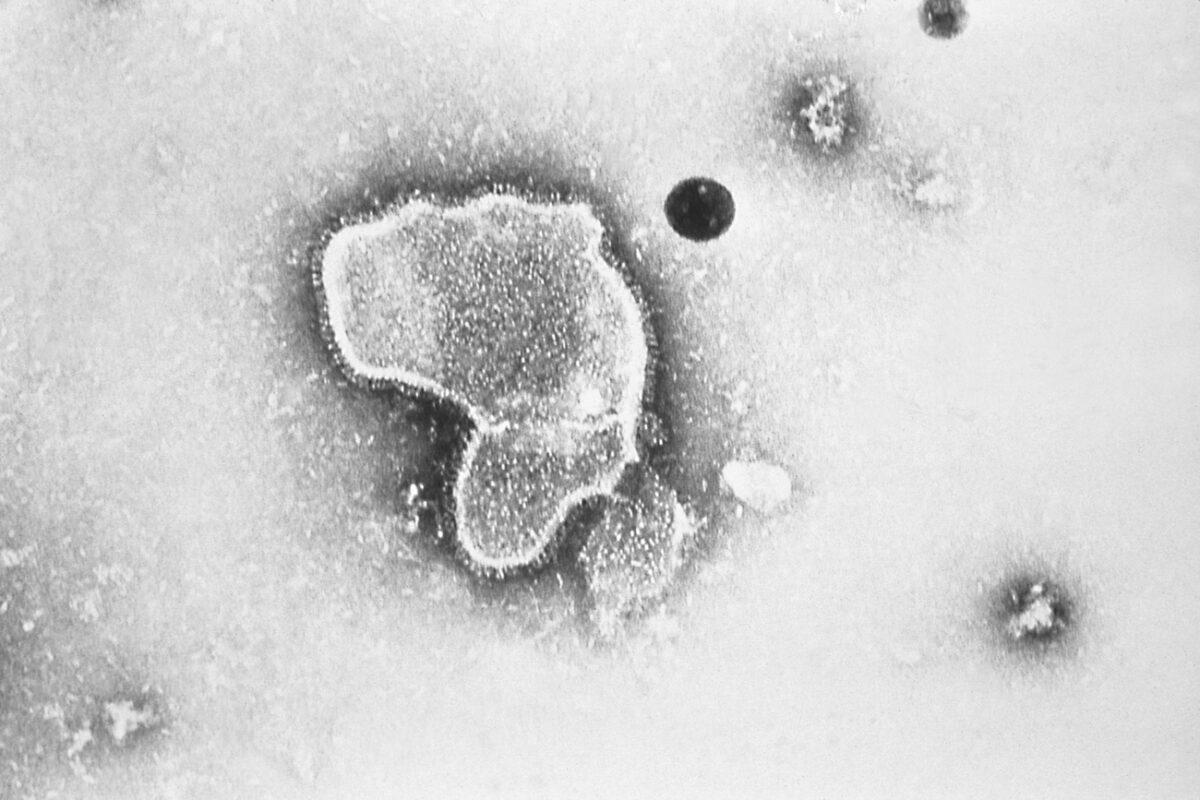 A human respiratory syncytial virus, also known as RSV, shown in a 1981 electron microscope image. (Centers for Disease Control and Prevention via AP)