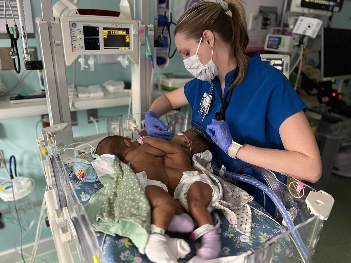 Twins AmieLynn Rose and JamieLynn Rae Finley in the hospital, prior to their separation surgery. (Courtesy of Cook Children's)