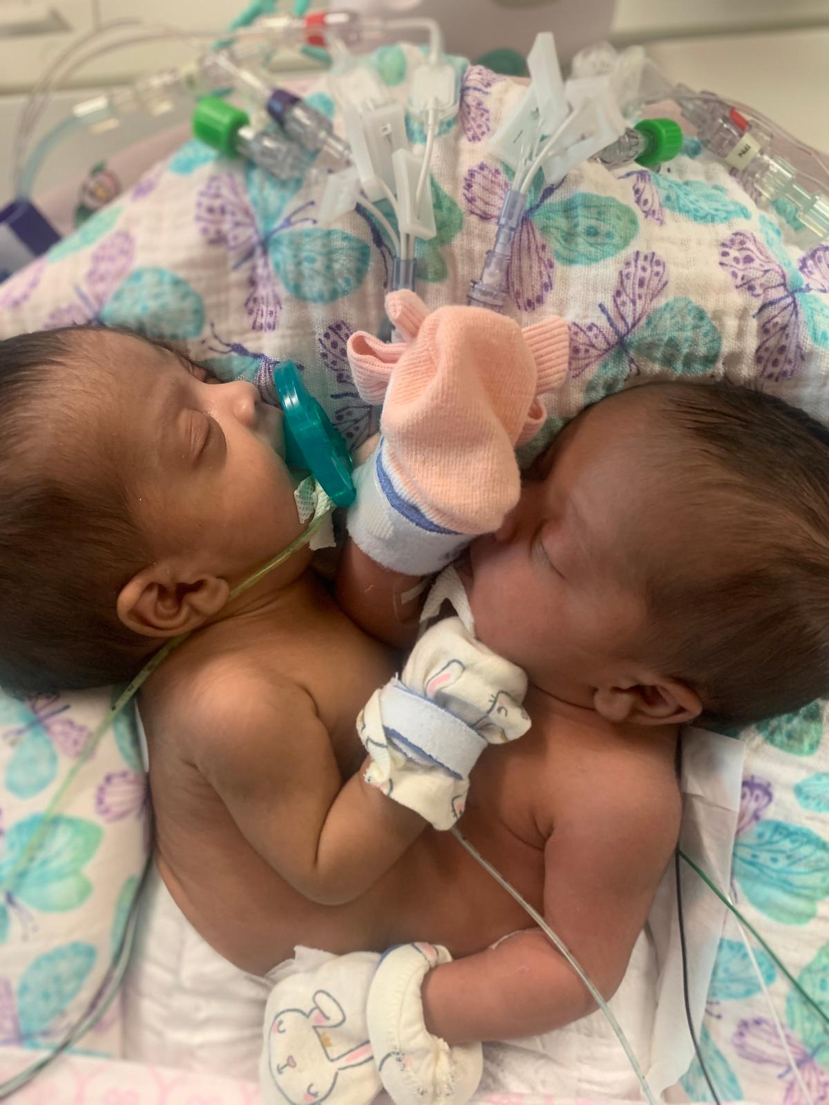 AmieLynn Rose and JamieLynn in the hospital, prior to being separated. (Courtesy of Cook Children's)
