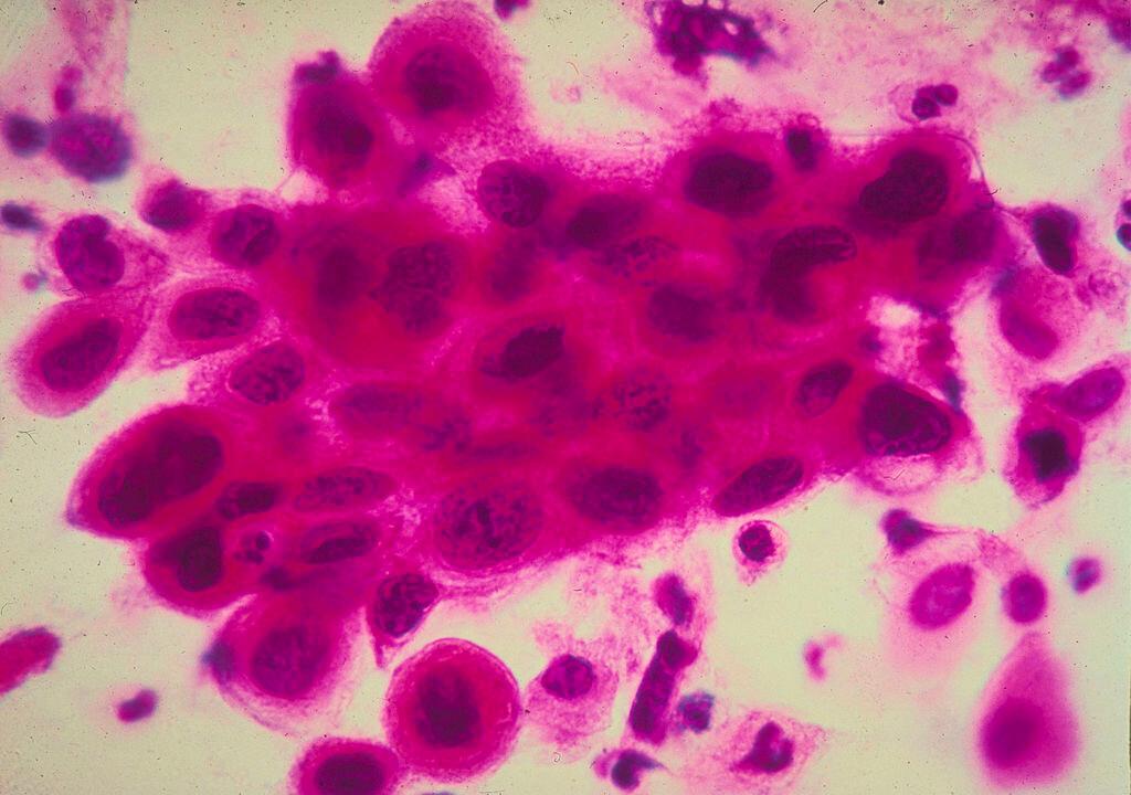 Over 14 Million Americans Living Near Facilities Releasing Cancer-Causing Gas: Report