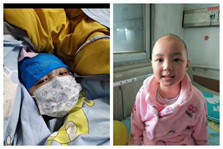 First-grader Xiao Ziyi was diagnosed with leukemia in December 2021 after receiving a COVID-19 vaccine made by Sinopharm. (Courtesy of Xiao Honghua)