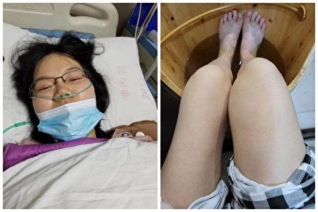 Liu Lifeng was diagnosed with Guillain Barré Syndrome after receiving the COVID-19 vaccine. (Courtesy of Liu Lifeng/The Epoch Times)