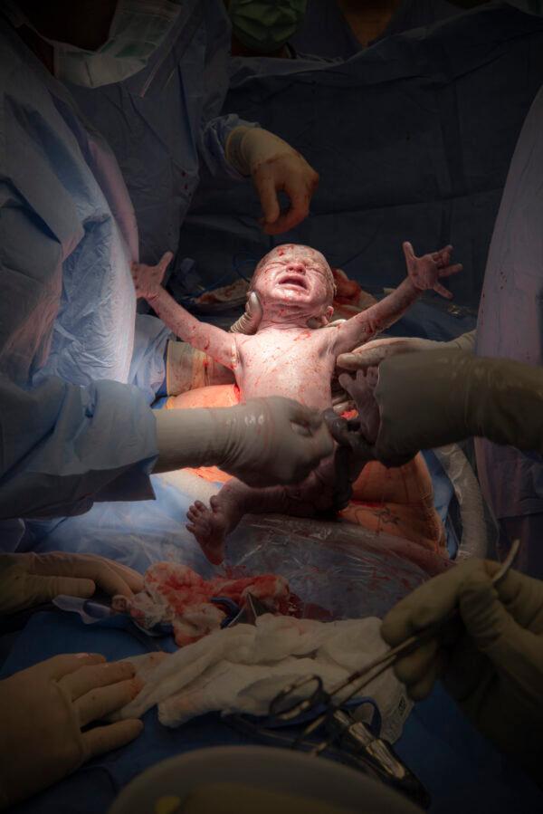 Ohio's Cleveland Clinic delivered a second baby in uterus transplant clinical trial in July 2020. Uterine transplants for women have become more viable as techniques and technology have increased. (Photo courtesy of Cleveland Clinic)