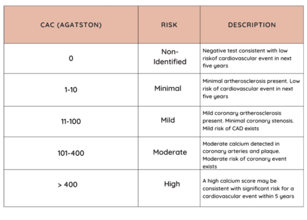 The Agatston Coronary Artery Calcium scores and how to assess risk for a cardiovascular event such as a heart attack or stroke. (The Epoch Times)