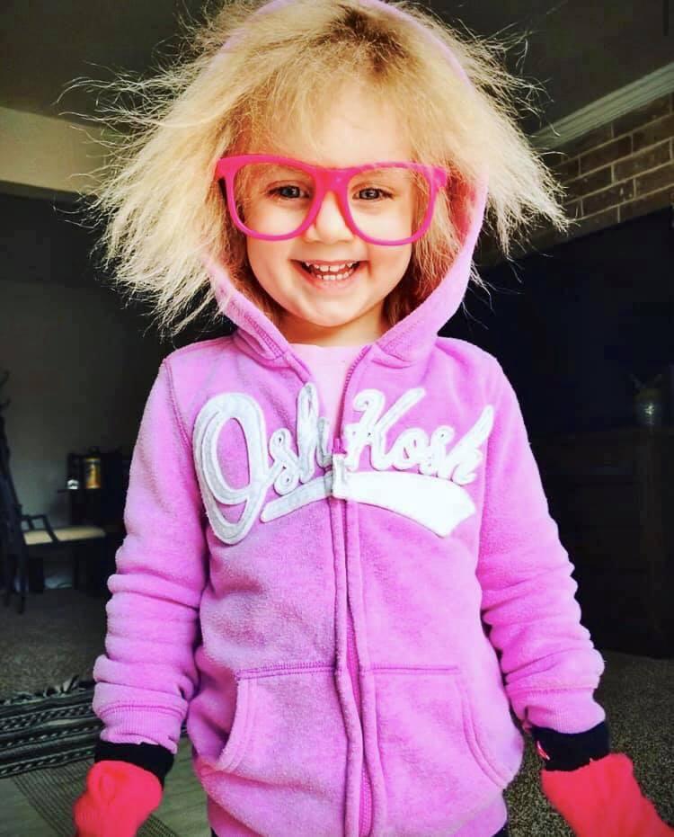 Taylor McGowan from Chicago suffers from Uncombable Hair Syndrome (UHS). (Courtesy of <a href="https://www.facebook.com/BabyEinstein2.0">Cara McGowan</a>)