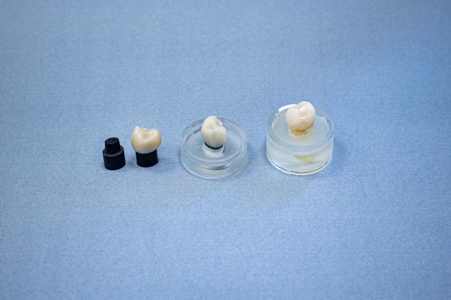 A ceramic crown is shown individually bonded to the new dentine analog materials, and on the right of the picture are extracted human teeth. (Courtesy of Hong Kong University)