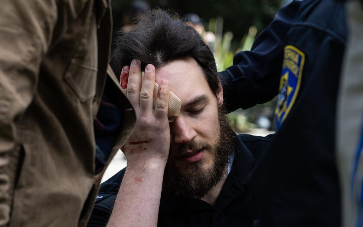 A man sits bleeding after being attacked by Antifa activists gathering in front of the California state Capitol building in Sacramento on March 10, 2023. (John Fredricks/The Epoch Times)
